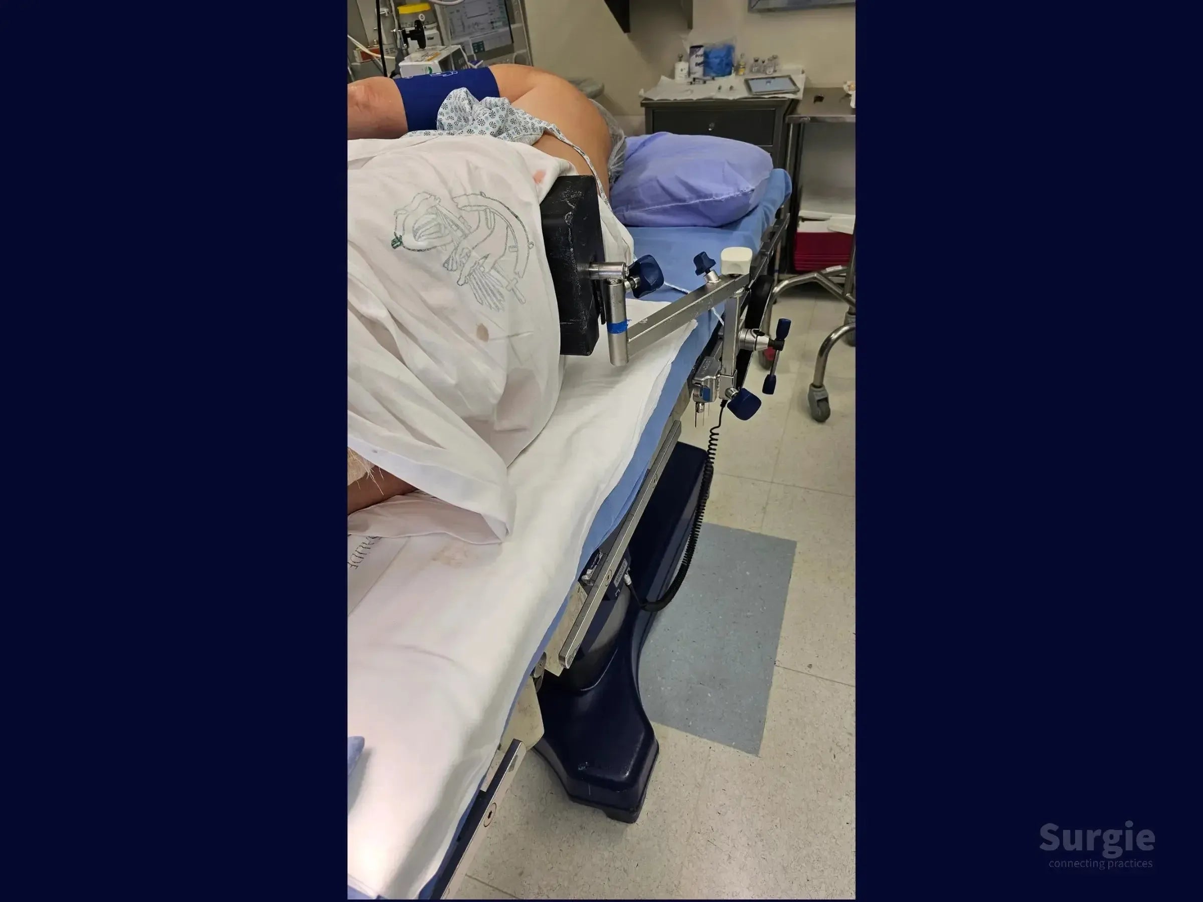 Patient in lateral decubitus position on an operating table with a metal surgical support device attached for ankle surgery.