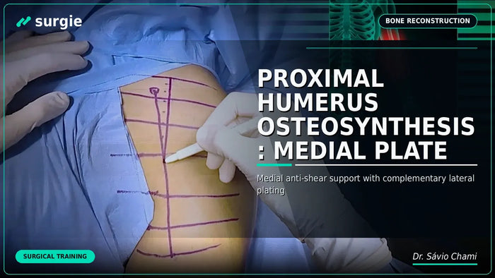 Osteossíntese do Úmero Proximal: Placa Medial