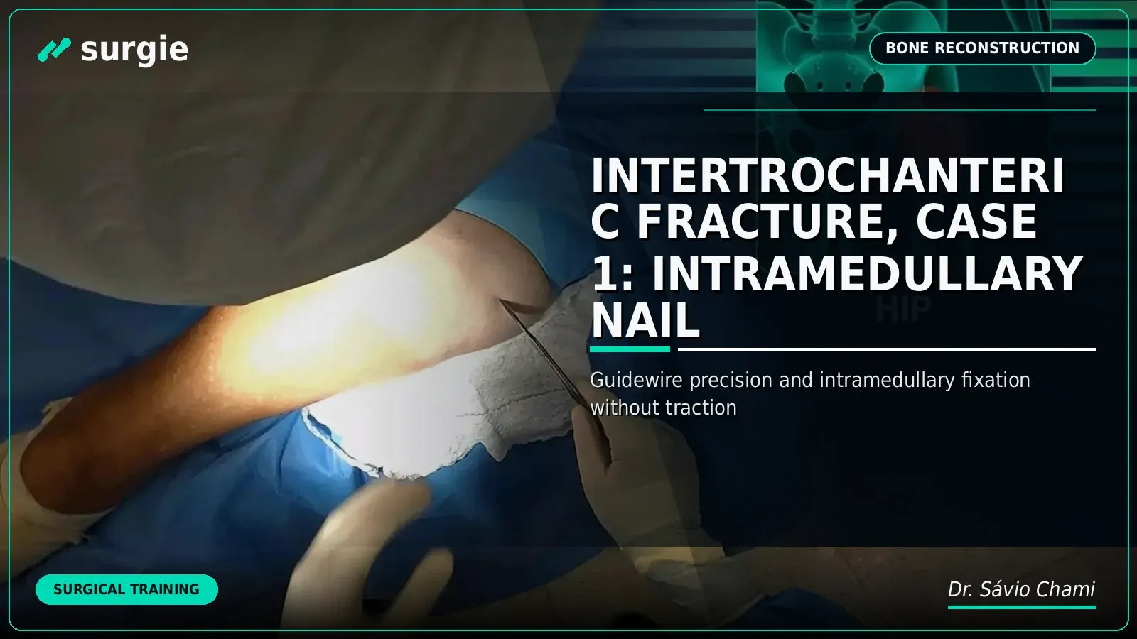 Intertrochanteric Fracture, Case 1: Intramedullary Nail