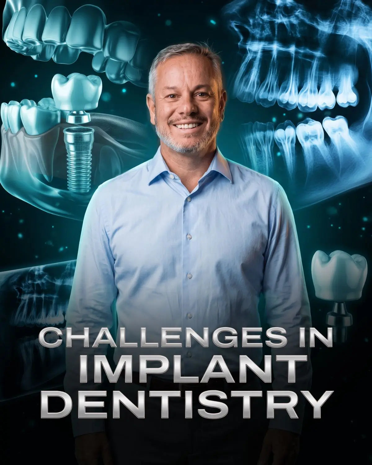 Challenges in Implant Dentistry