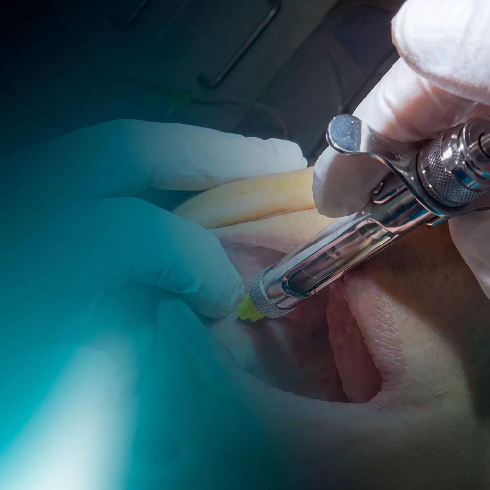 Odontologia de Implantes