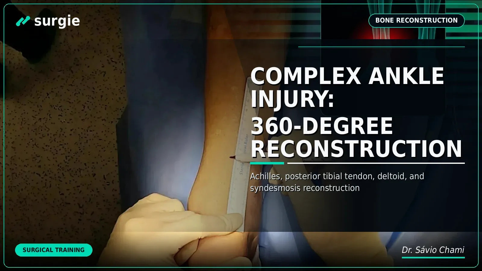 Complex Ankle Injury: 360-Degree Reconstruction
