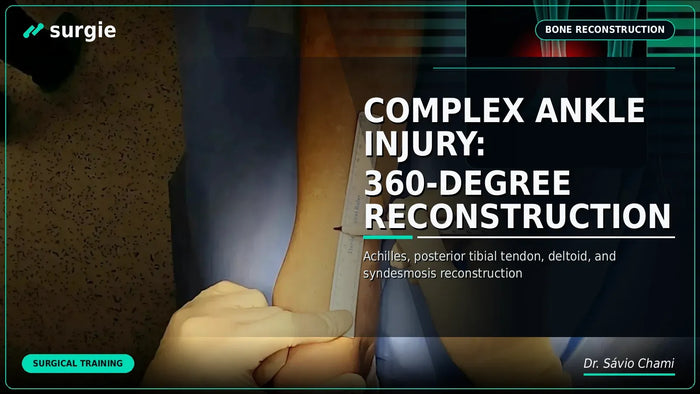Lesão Complexa no Tornozelo: Reconstrução 360 Graus
