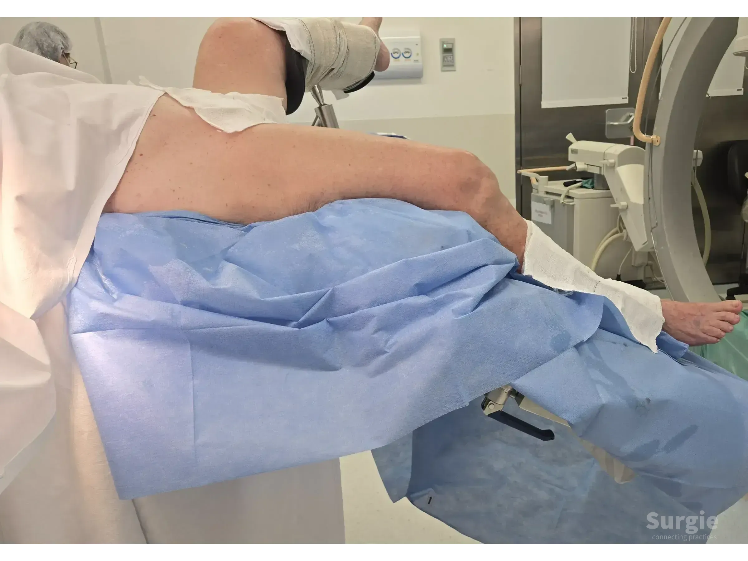 Patient positioned on operating table for retrograde femoral intramedullary nailing with blue surgical drapes.