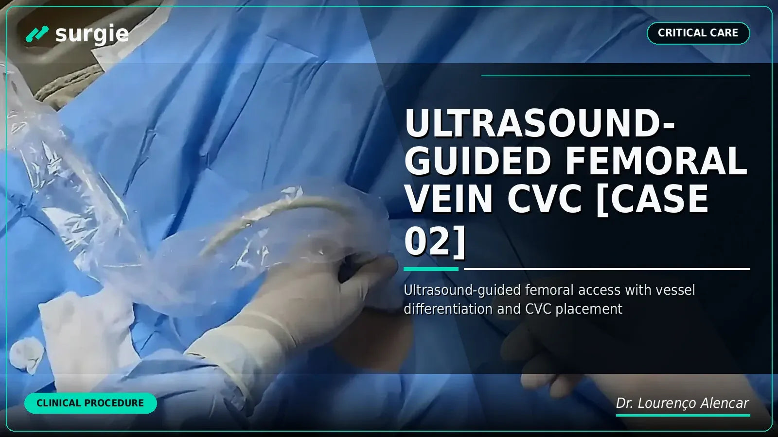 Ultrasound-Guided Femoral Vein CVC [CASE 02]