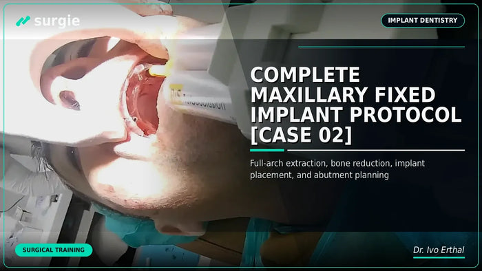 Complete Maxillary Fixed Implant Protocol [CASE 02]
