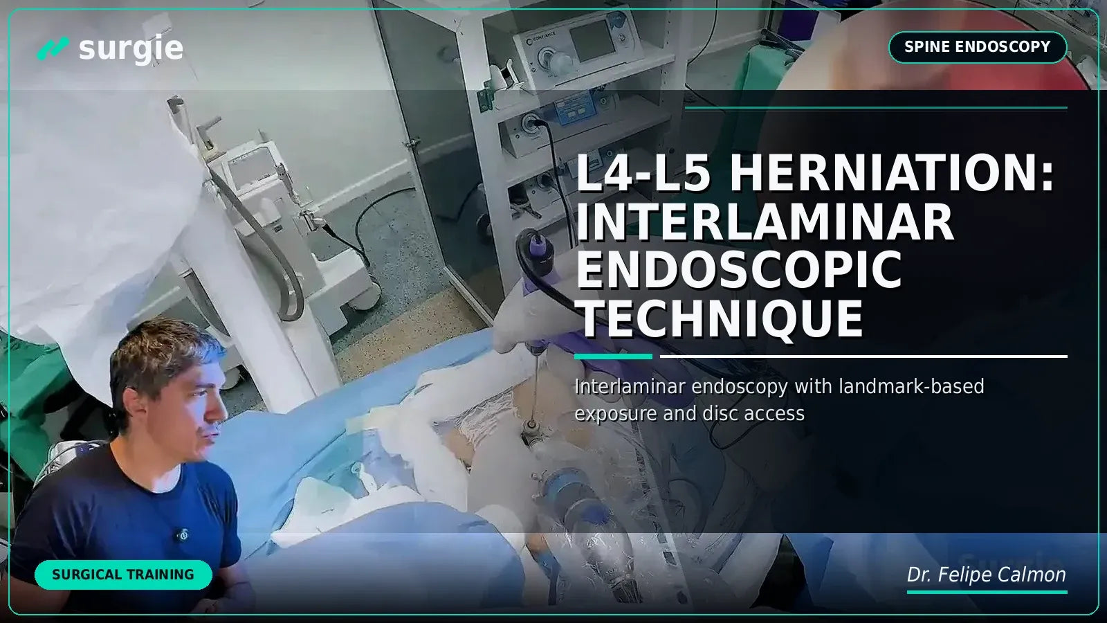 L4-L5 Herniation: Interlaminar Endoscopic Technique