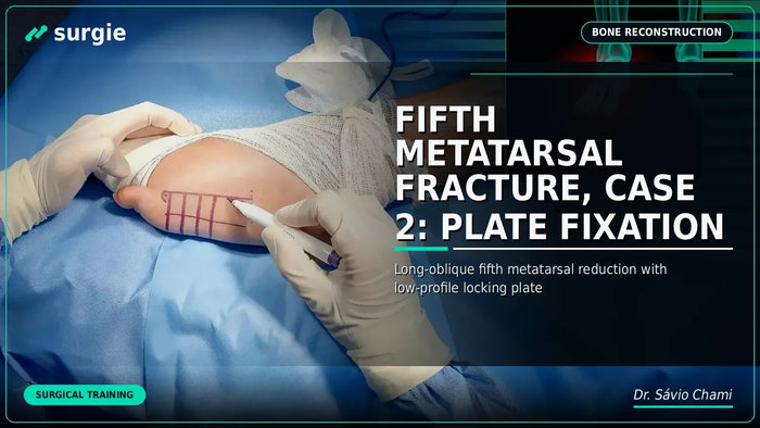 Fifth Metatarsal Fracture, Case 2: Plate Fixation