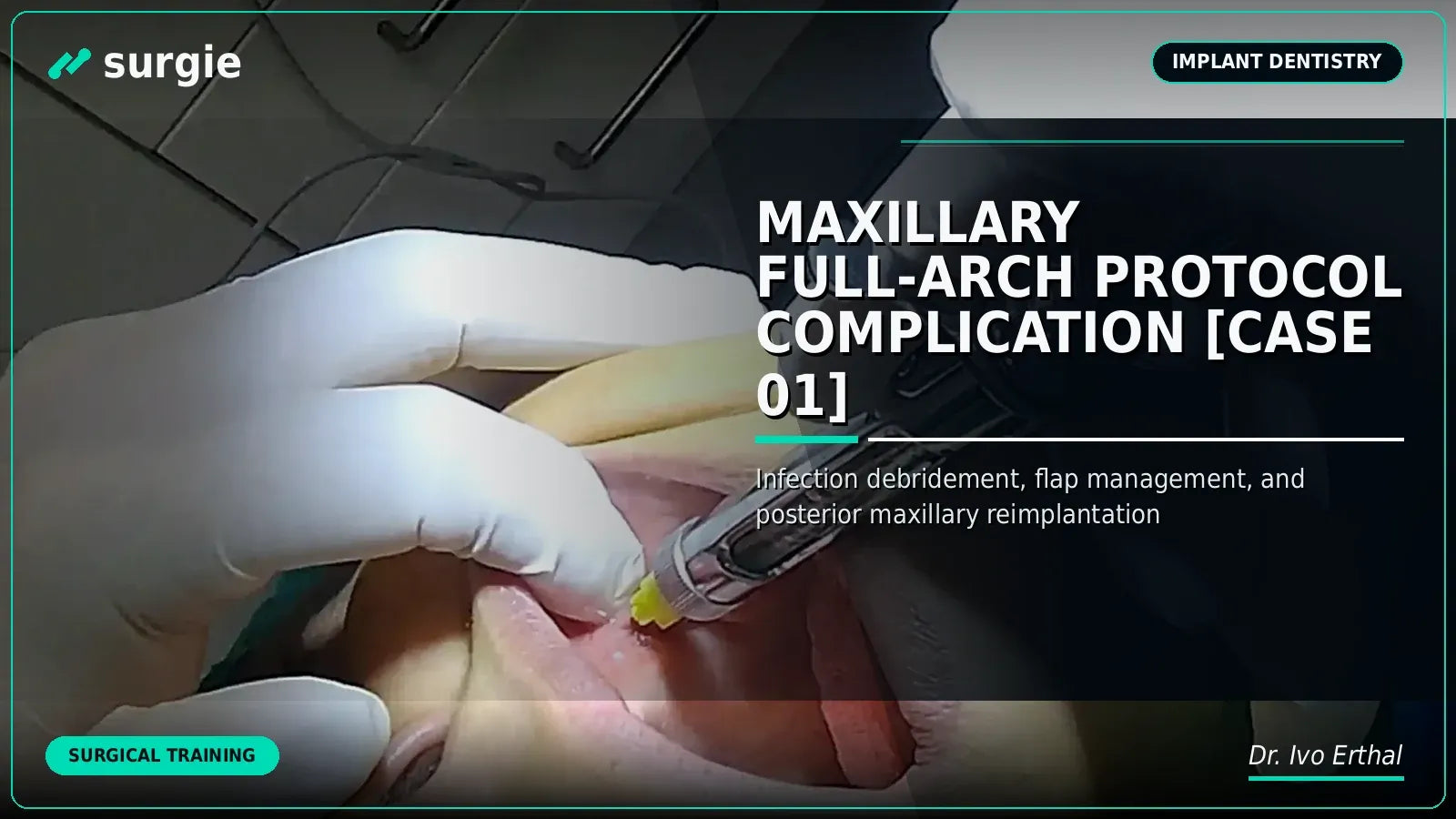 Maxillary Full-Arch Protocol Complication [CASE 01]