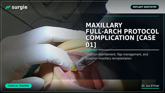 Maxillary Full-Arch Protocol Complication [CASE 01]