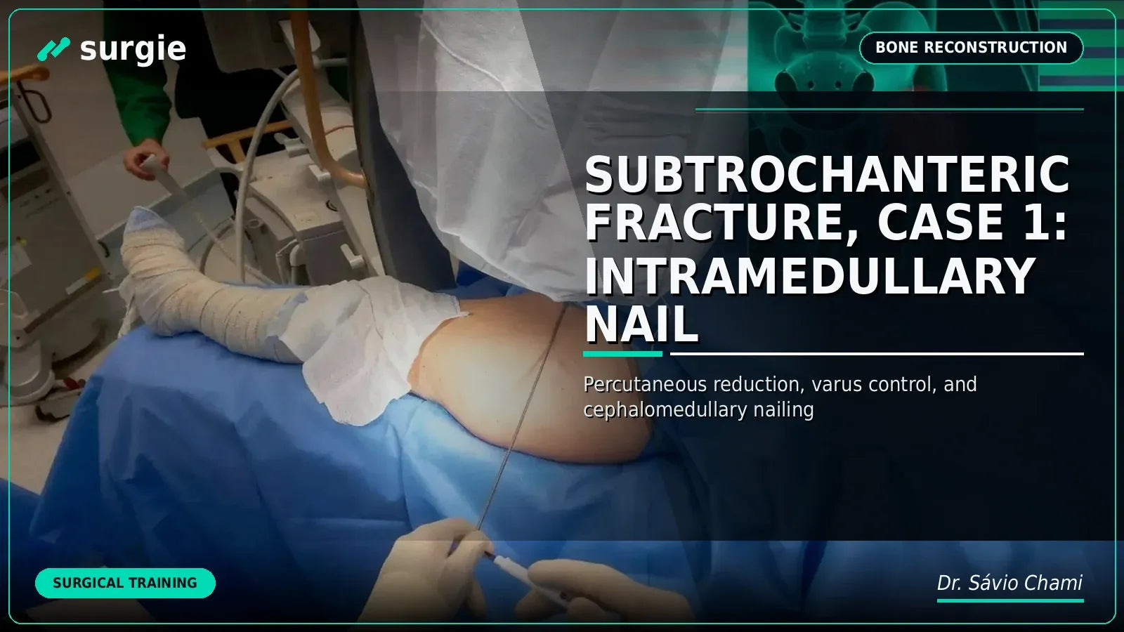 Subtrochanteric Fracture, Case 1: Intramedullary Nail