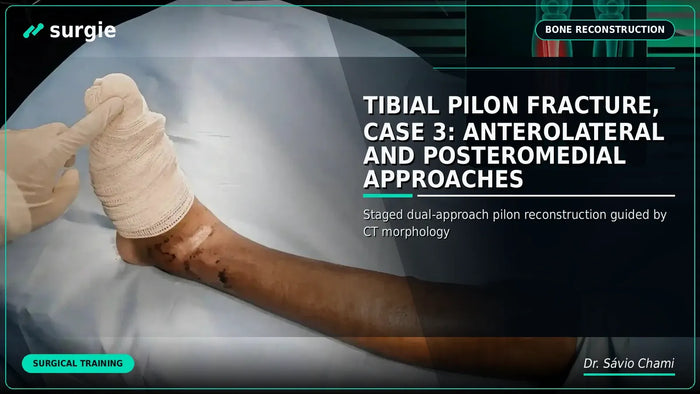 Tibial Pilon Fracture, Case 3: Anterolateral and Posteromedial Approaches