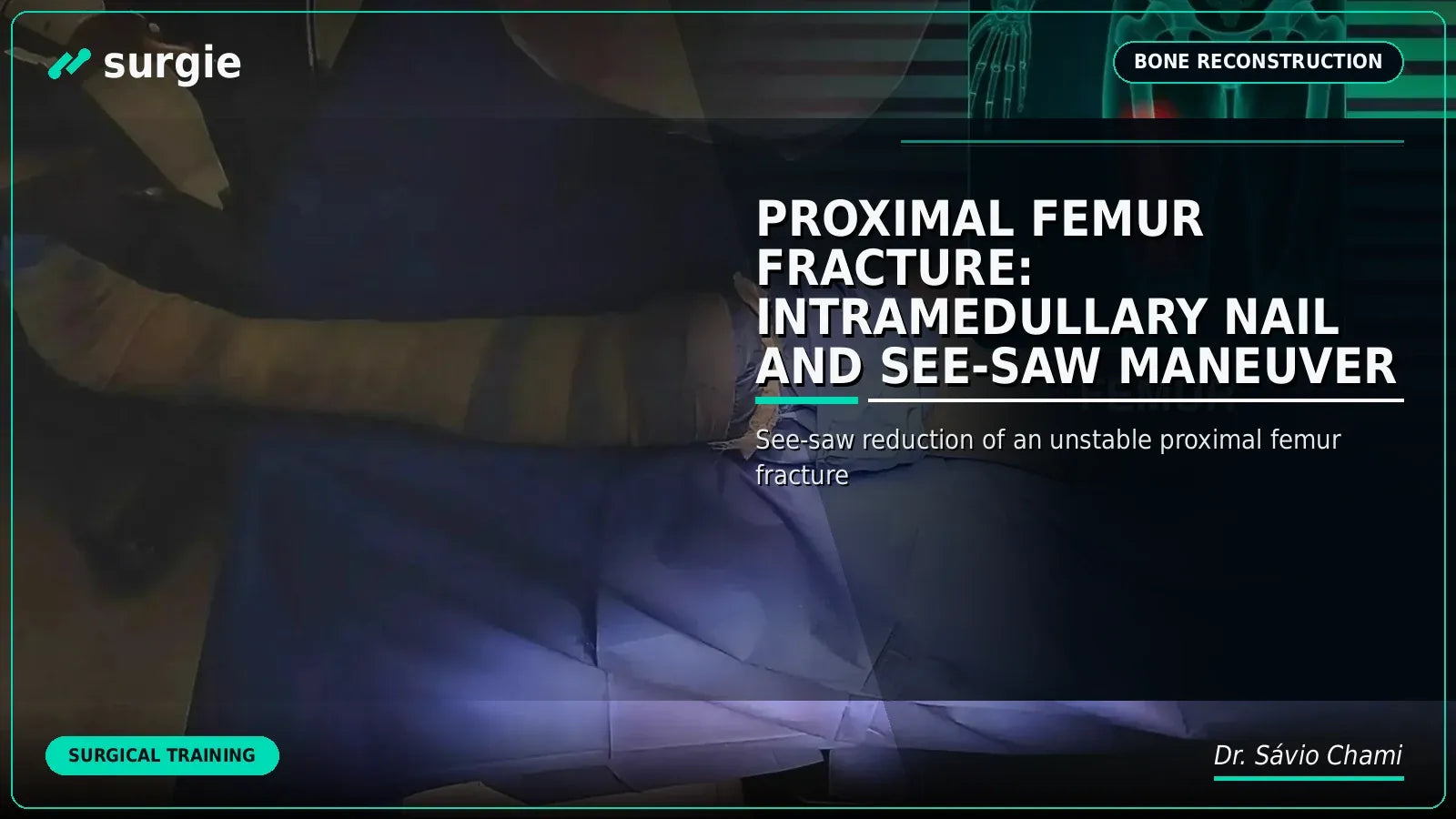 Proximal Femur Fracture: Intramedullary Nail and See-Saw Maneuver